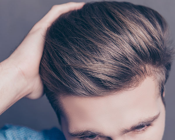 are finasteride results permanent